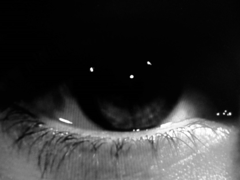 générique vertigo IPL 2018 r.jpg